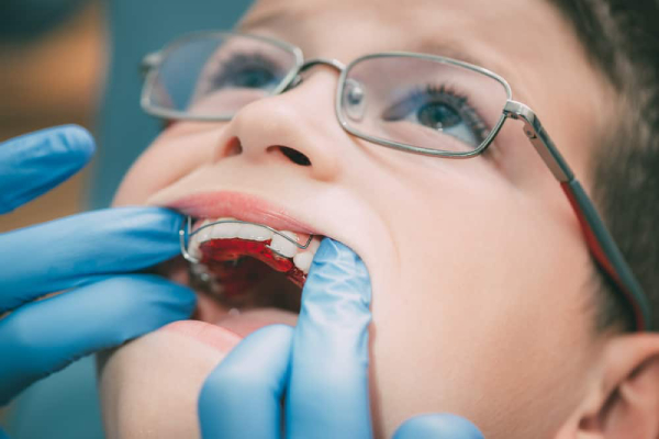 How to Tell When Your Kids Need Orthodontic Support