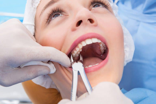 Tooth Extraction: What To Expect Before And After